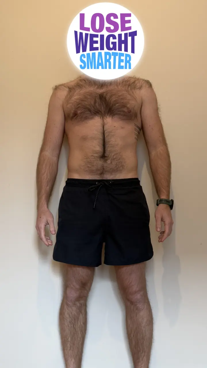 Before weight loss
