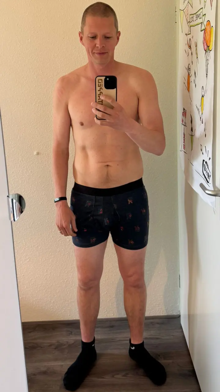 After weight loss