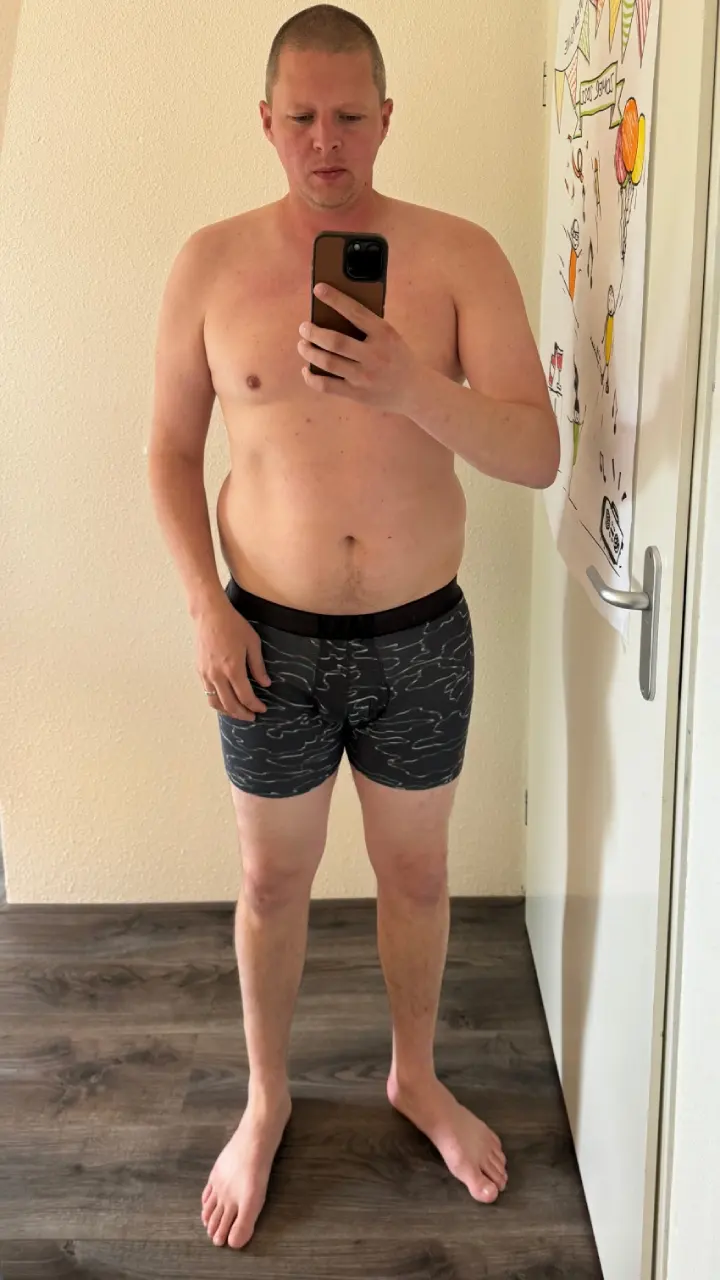 Before weight loss
